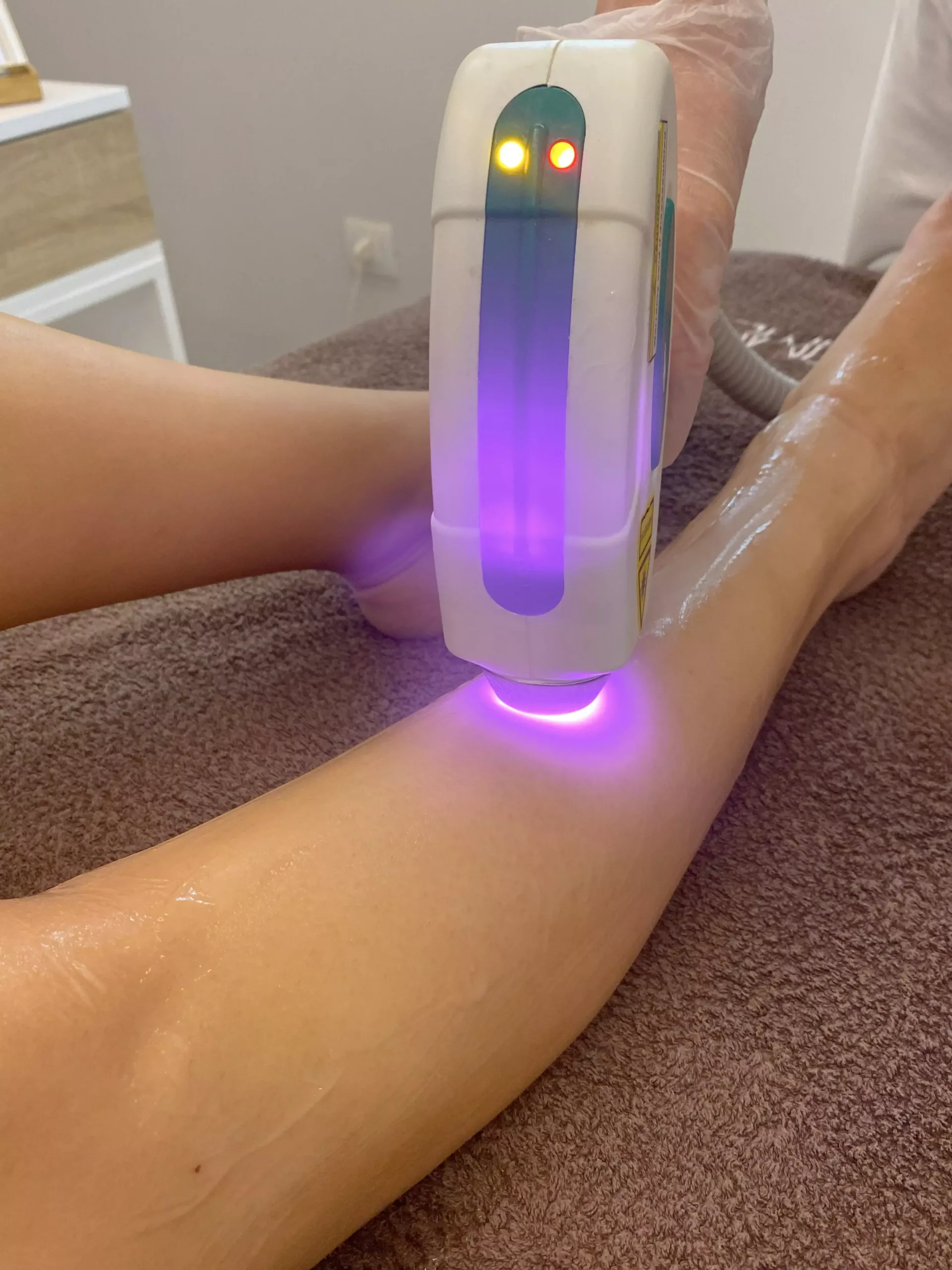 Epilazione laser - Hintime Beauty & Spa Treviglio